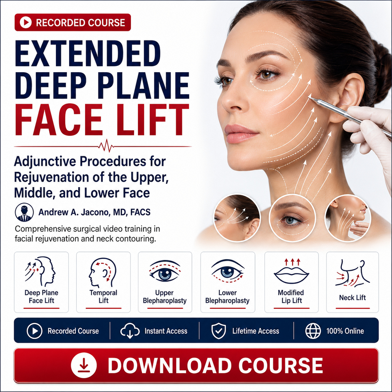 Extended Deep Plane Face Lift and Adjunctive Procedures for Rejuvenation of the Upper, Middle, and Lower Face